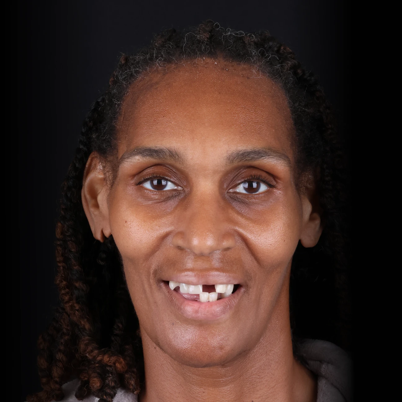 before-dionna before-dionna